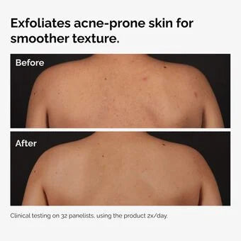 The Ordinary Salicylic Acid 0.5% Body Serum